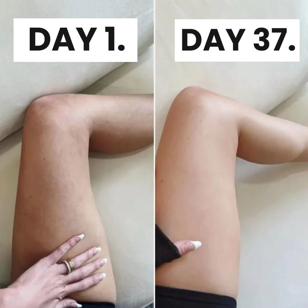 Cellulite Relief Kit